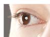 Alergii oculare - Conjunctivita alergica