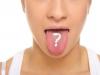5 schimbari de aspect ale limbii care pot semnala o boala grava