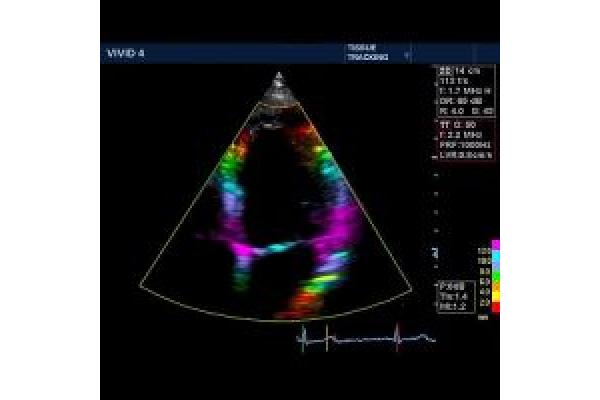 MEDIST Imaging & Point of Care - v4_tissue_500.jpg