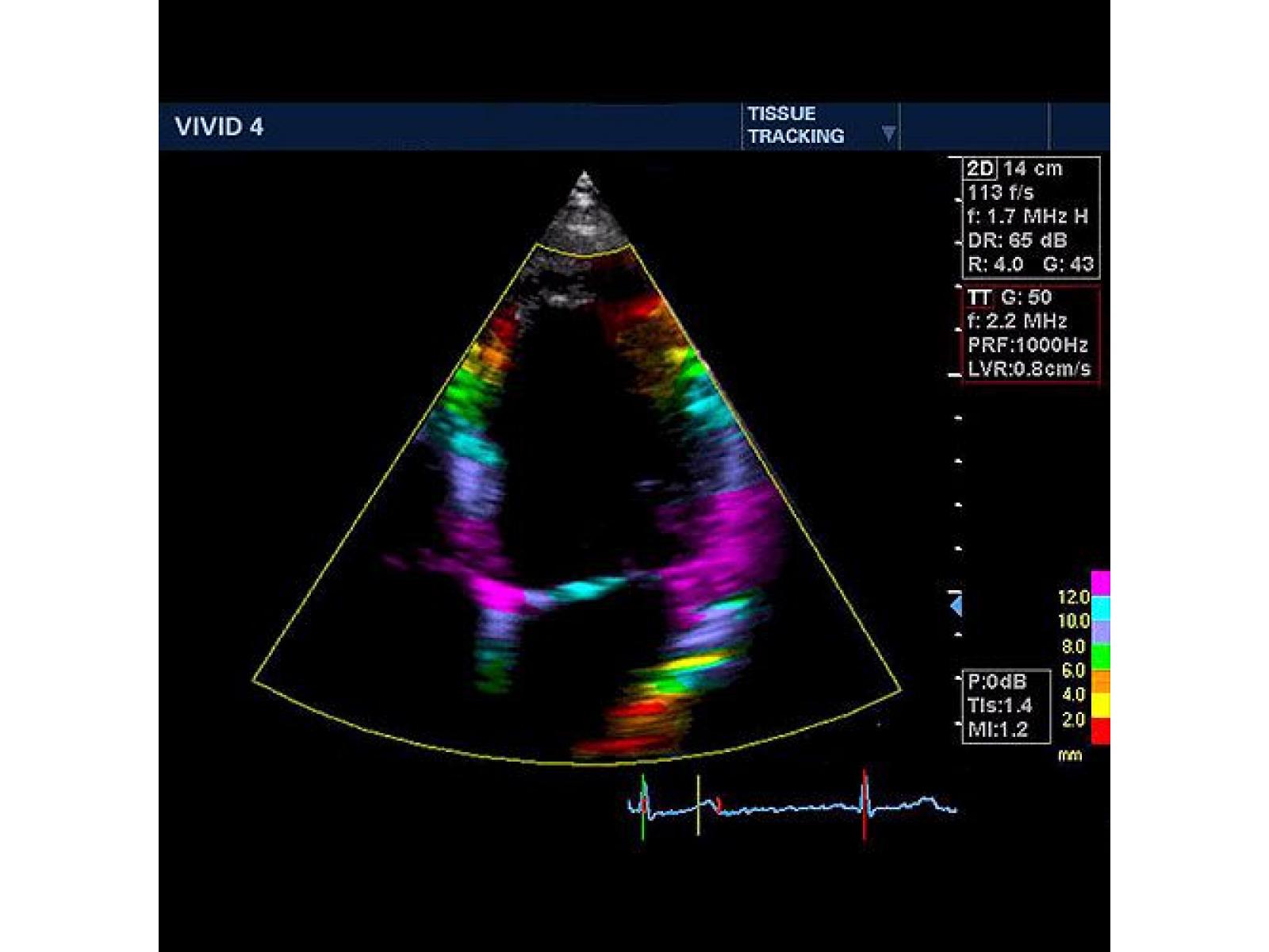 MEDIST Imaging & Point of Care - v4_tissue_500.jpg
