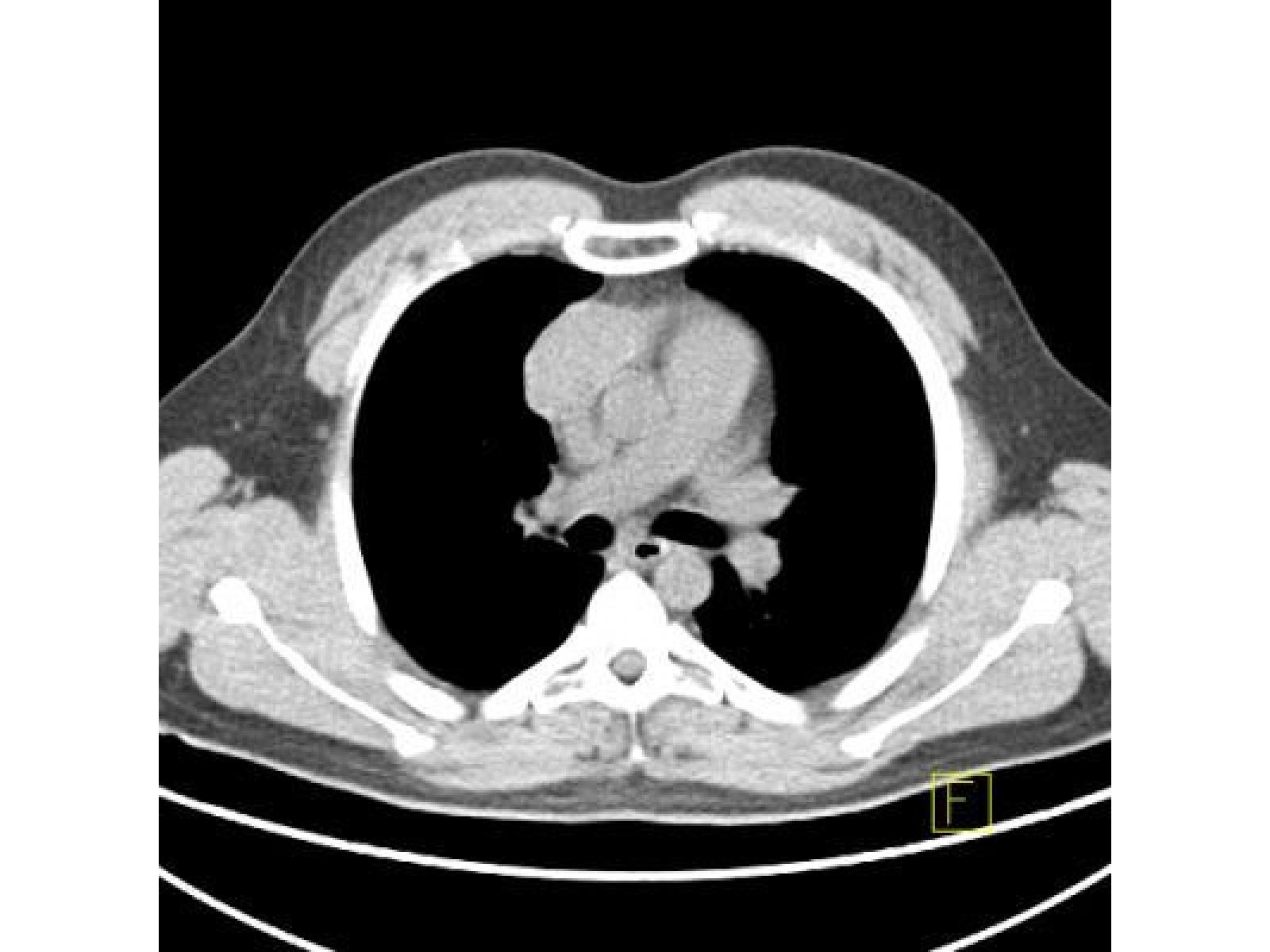 Centrul de Diagnostic Pozitron Diagnosztika PET CT - CT.jpg