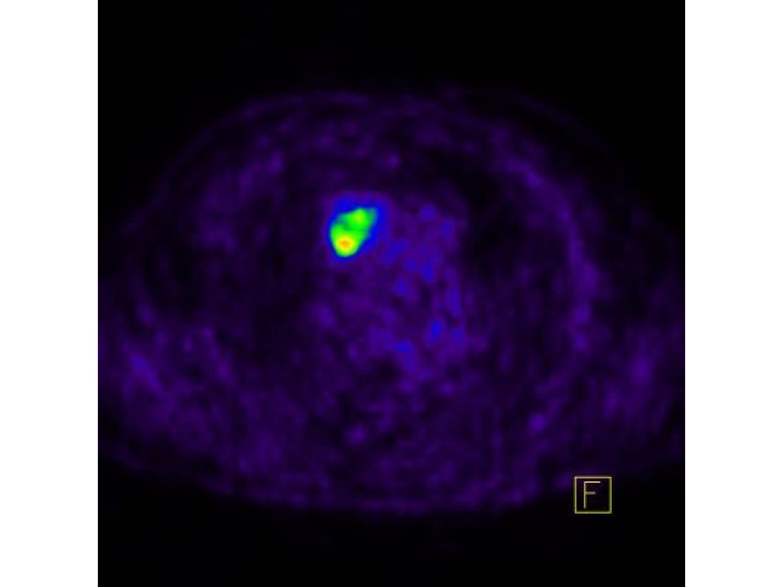 Centrul de Diagnostic Pozitron Diagnosztika PET CT - PET.jpg