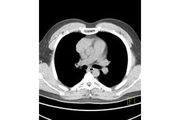 Centrul de Diagnostic Pozitron Diagnosztika PET CT - CT.jpg