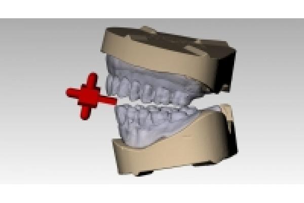 Dr.Cristian Gheorghiu - medic dentist implantolog - 3planificare_3d.jpeg