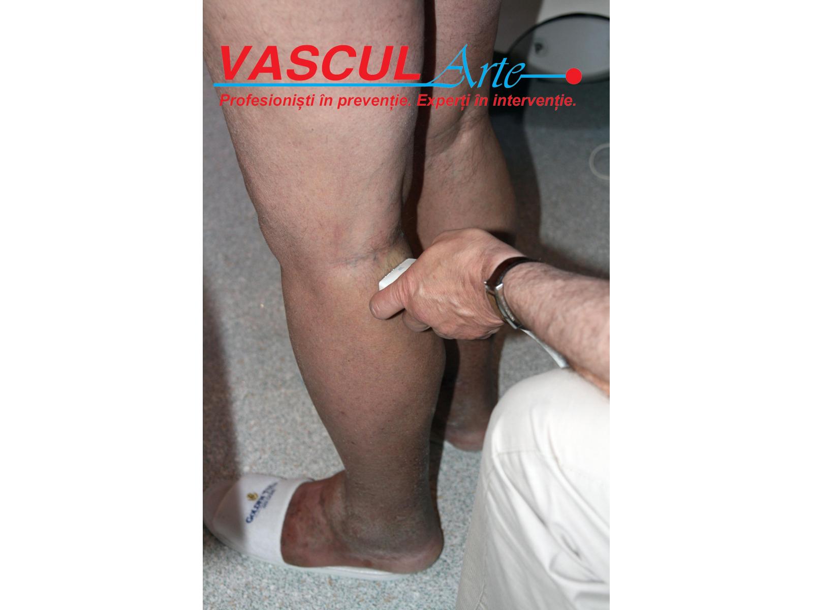 CLINICA VASCUL ARTE - IMG_9102.jpg