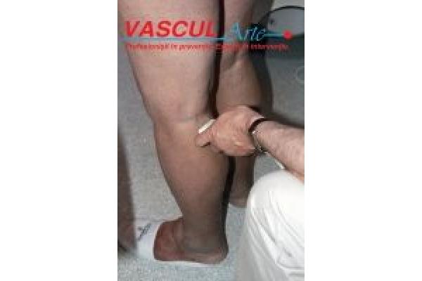 CLINICA VASCUL ARTE - IMG_9102.jpg