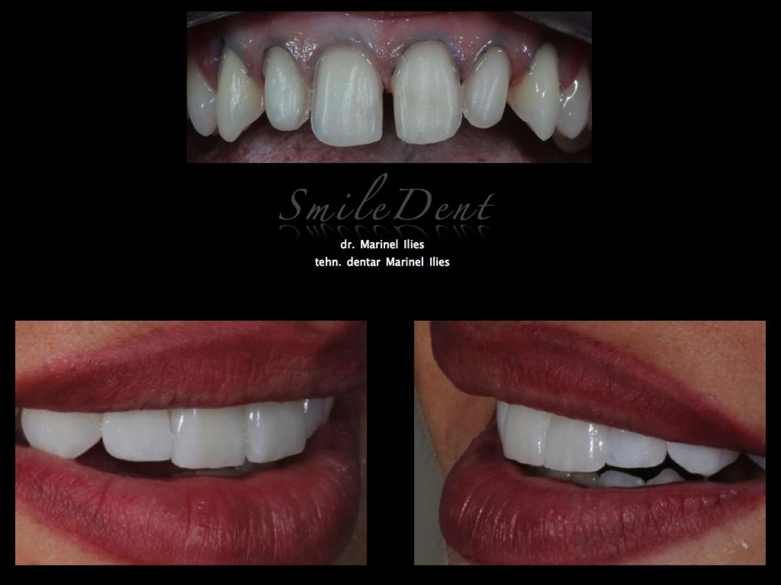 Smile Dent - cojoc.018.jpg