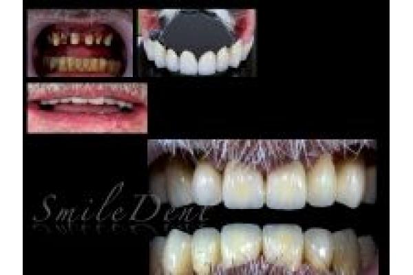 Smile Dent - cornel_scheletata.012.jpg