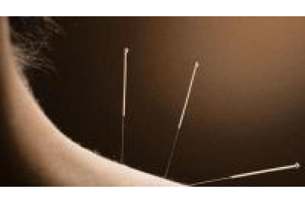 LEON CLINIQUE - acupuncture_41447900.jpg