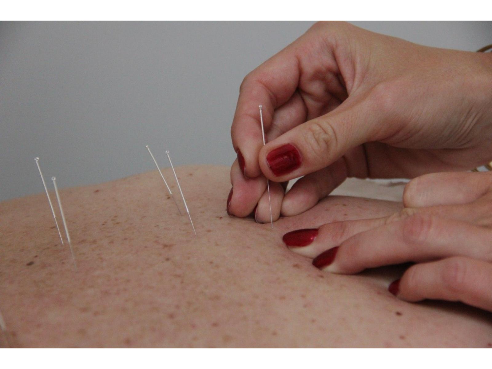 Vasiloiu Simina Codruța - cabinet medical de acupunctură - ACP_7.jpg