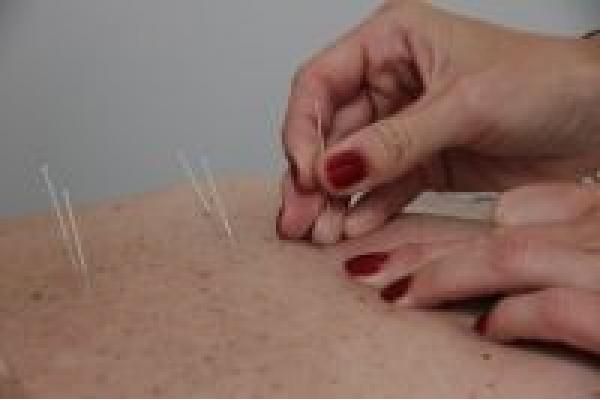 Vasiloiu Simina Codruța - cabinet medical de acupunctură - ACP_7.jpg