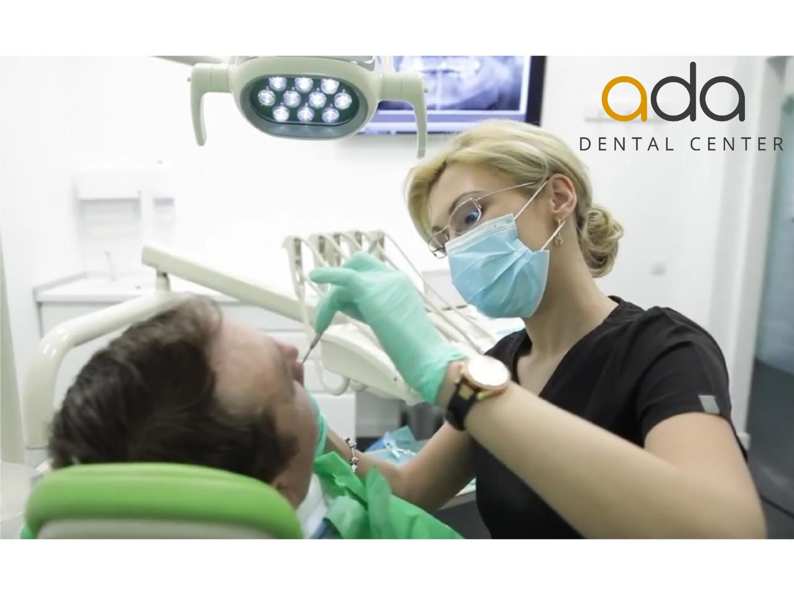 Ada Dental Center - parodontologie1.jpg