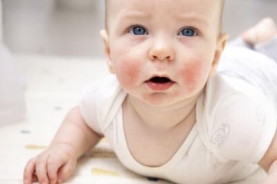 Dermatita atopică la bebeluși și copii: ghid de îngrijire pentru părinți