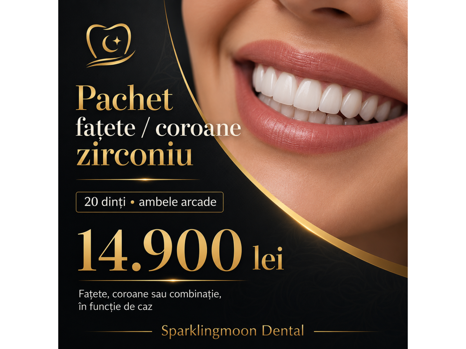 Sparklingmoon Dental - fatete-zirconiu.png