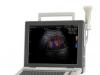 ECOGRAF PORTABIL – SONOACE R3-DOPPLER COLOR