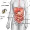 Refluxul gastro-esofagian