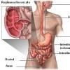 Boala Crohn - inflamatia colonului