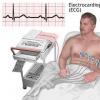 Electrocardiograma