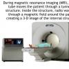 Imagistica prin rezonanta magnetica (IRM sau RMN)