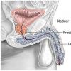 Prostata si problemele ei