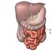 Diverticulul Meckel