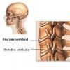 Reumatismele degenerative - artroza si spondiloza