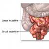 Ischemia entero-mezenterica