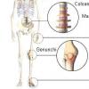 Indicatiile opioidelor in osteoartrita