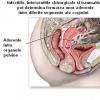 Boala inflamatorie pelvina si infertilitatea