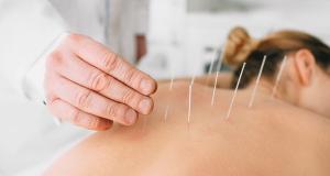 Beneficiile acupuncturii