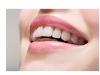 Bruxism - Intrebari frecvente referitoare la scrasnirea dintilor (bruxism)