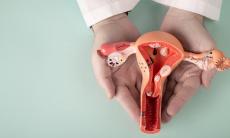 Mituri despre endometrioza