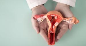 Mituri despre endometrioza