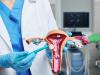 Miomectomia - interventia de indepartare a fibroamelor uterine