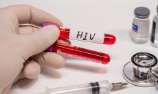 Sindromul imunodeficientei dobandite si complicatiile neurologice