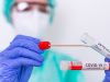 Cand se recomanda testele PCR si testele pentru anticorpi COVID-19.  Specialistii MedLife explica
