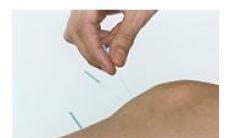 Acupunctura si infectiile urinare