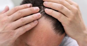 Alopecia de tractiune - cand poate fi necesar implantul de par?