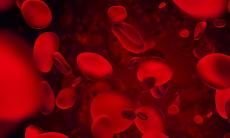 Anemia - cauze, simptome si tratament