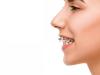Dantura de revista: scurt ghid privind optiunile de tratament ortodontic