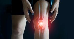 Gonartroza - osteoartrita genunchiului 