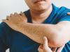 Artroza umarului (omartroza) – de ce apare si cum poate fi tratata