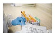 Cancerul la gat legat de HPV ar putea fi anticipat prin analize de sange