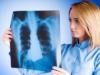 Barbatii romani, afectati de cancer pulmonar intr-o proportie alarmanta