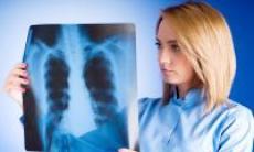 Barbatii romani, afectati de cancer pulmonar intr-o proportie alarmanta