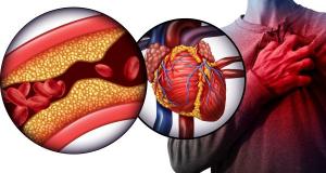 Exista vreo legatura intre masa musculara si riscul de boli cardiovasculare