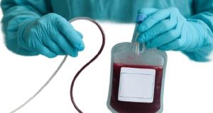 Recoltarea celulelor stem la nastere in contextul prematuritatii si al tipului de nastere: naturala vs. cezariana