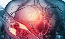 O problema mai veche – colesterolul