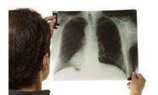 Bolile Pulmonare – subiect de dezbatere la Conferinta Nationala a Pacientilor, editia a II a