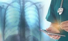 Complicatii ce apar in urma infectiei Covid19